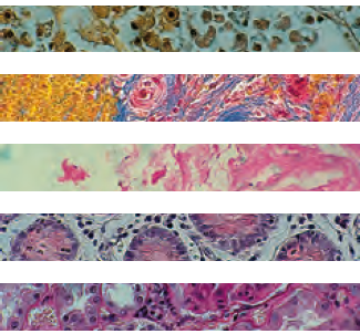 IHC & Immunohistochemistry